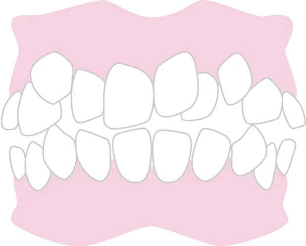 叢生「そうせい」